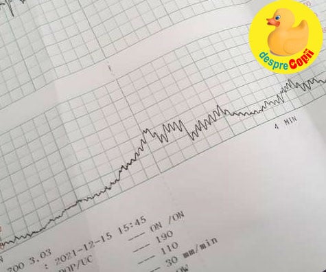 Au inceput sa apara unele dureri in saptamana 36 iar medicul mi-a recomandat testul de stres - jurnal de sarcina