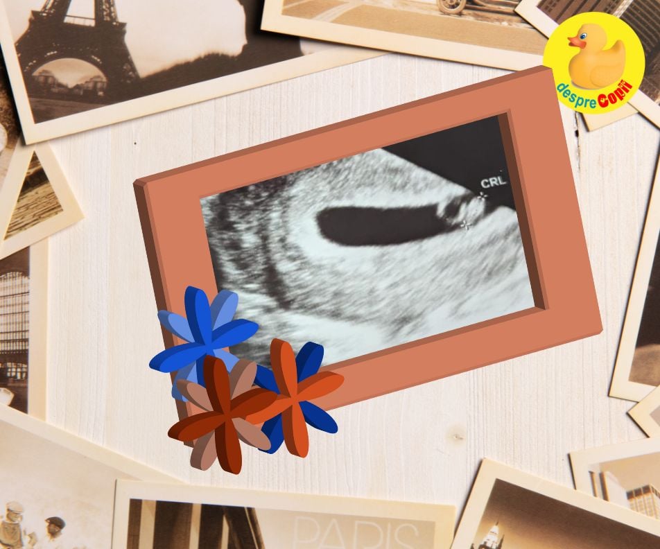 Saptamana 7: prima incercare si prima reusita de a ramane insarcinata - jurnal de sarcina
