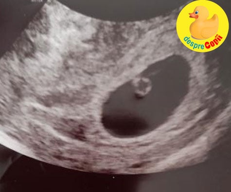 Vine bebe 2: avem un embrion in saptamana 7 dupa 2 saptamani care au trecut cat in doi ani - jurnal de sarcina