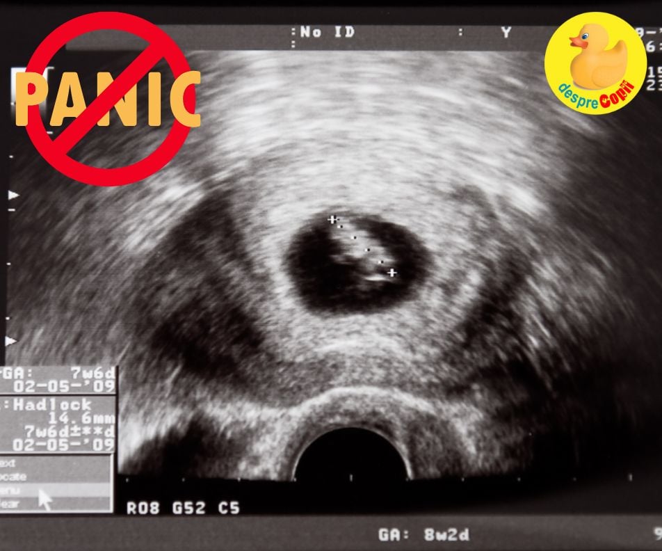 Saptamana 7 cu frica si panica: placenta era putin dezlipita - jurnal de sarcina