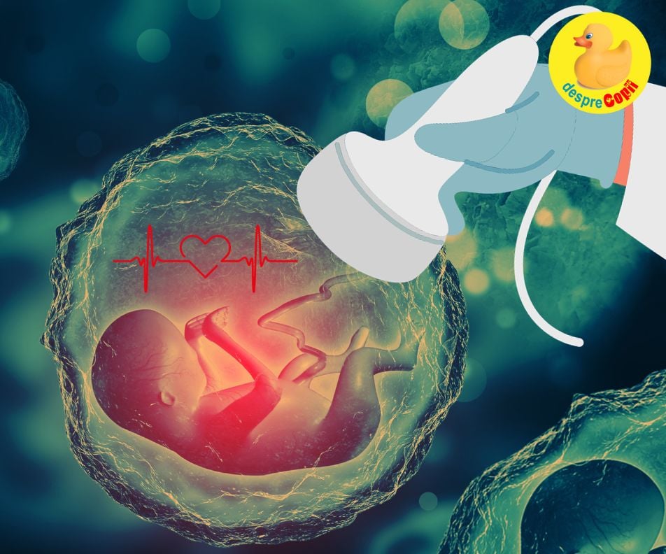 La a treia sarcina am ales sa facem prima ecografie in saptamana 9 - jurnal de sarcina