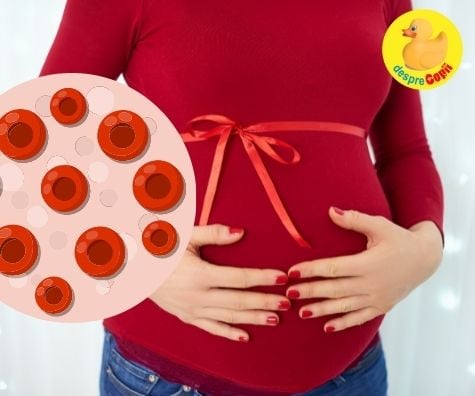 Anemia in sarcina: simptome si ce e de facut