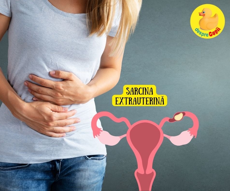 Sarcina extrauterina (ectopica) incepe ca o sarcina normala. Adevărul despre ingrijire si tratament - sfatul medicului