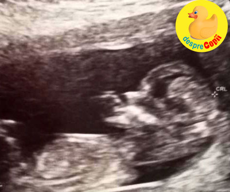 Sexul bebelusului la 12-13 saptamani - jurnal de sarcina