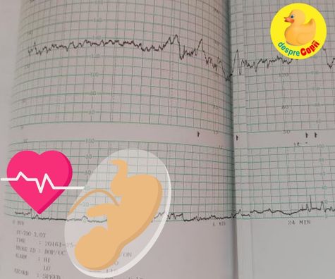 Am facut cardiotocografia sau testul fetal non-stres in saptamana 38 de sarcina - jurnal de sarcina