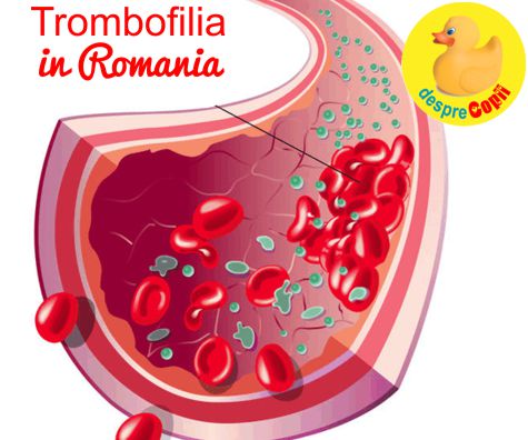 Ce este trombofilia si de ce pare sa fie atat de populara in Romania?
