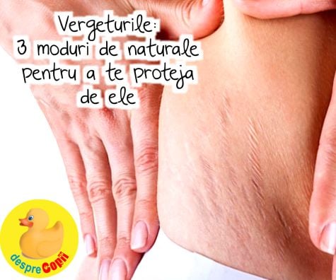 Vergeturile: 3 moduri naturale pentru a te proteja de ele
