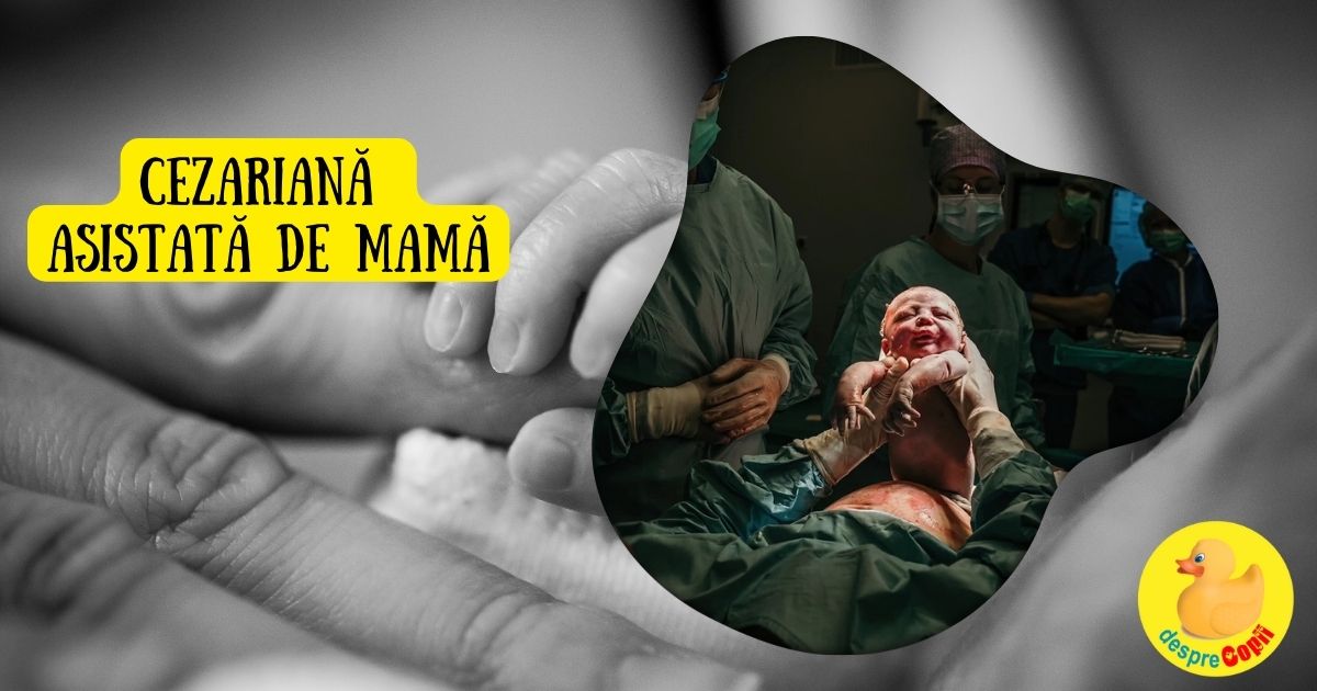 Nasterea cezariana asistata de mama sau Cezariana ca o experienta speciala prin implicarea mamei