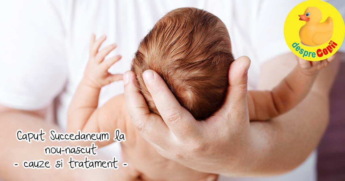 Traumatismul obstetrical la nou-nascut sau caput succedaneum - cauze si tratament