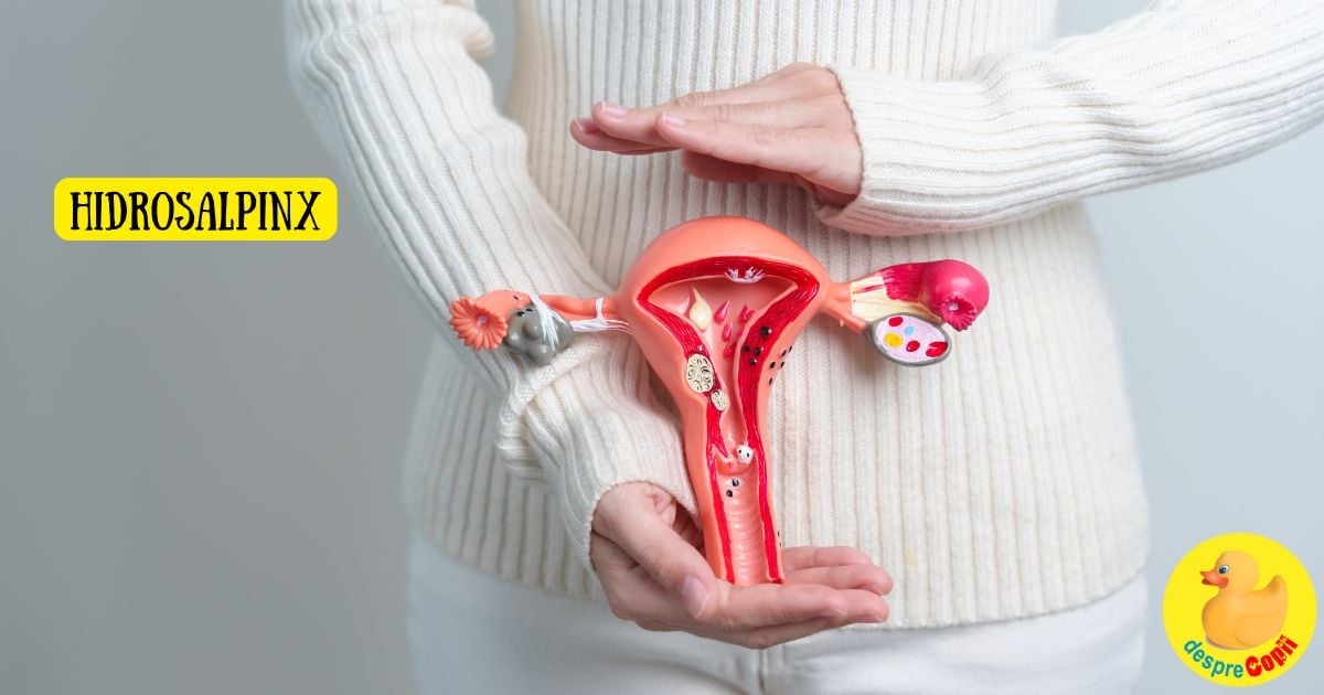 Hidrosalpinx si impactul sau asupra fertilitatii