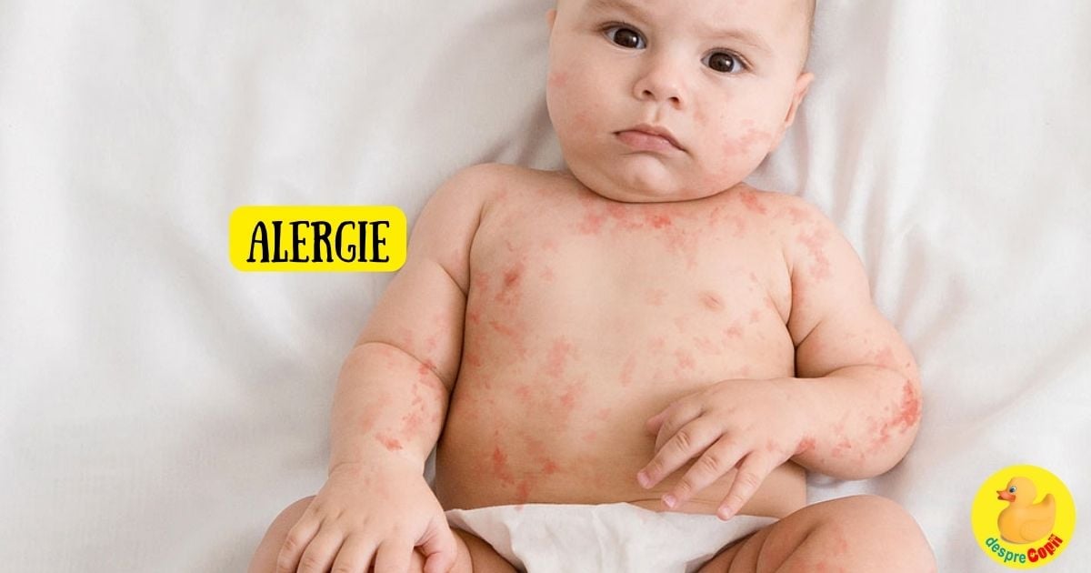 Ce alimente pot produce alergie bebelusului? Iata cum poti sa le depistezi