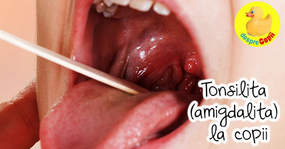 Amigdalita (Tonsilita) la copil: cauze si tratament