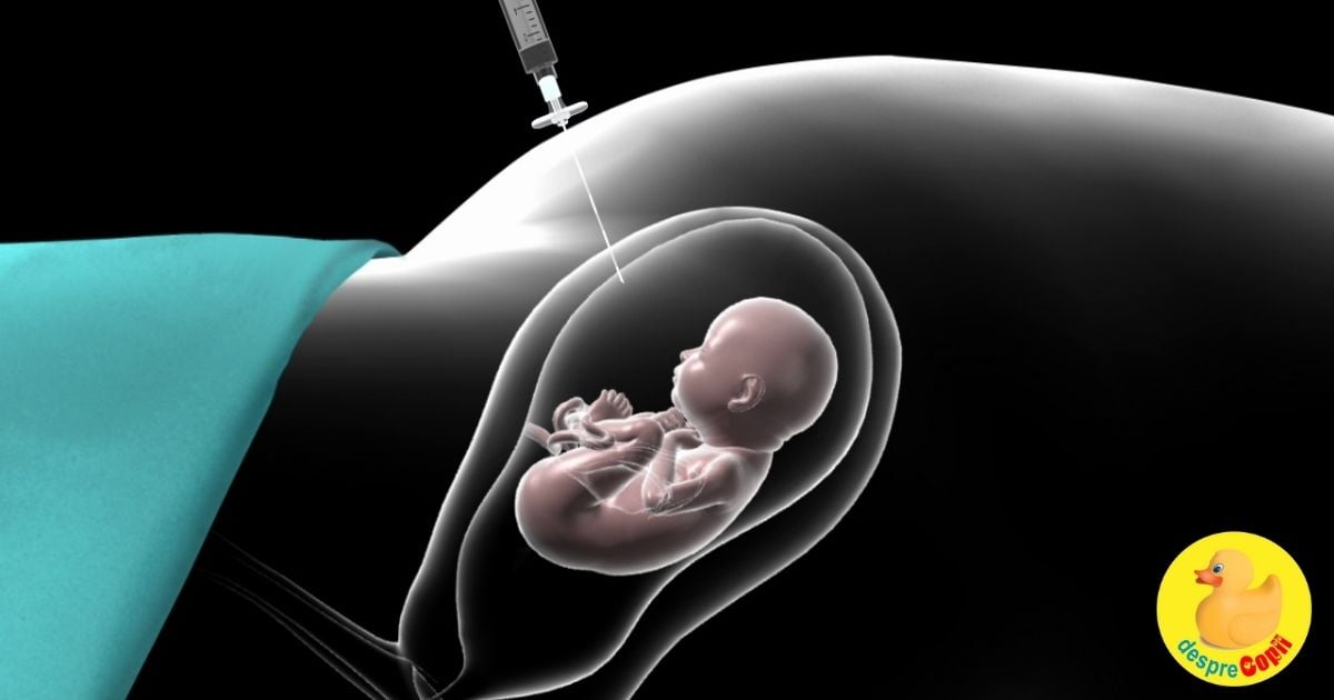 Amniocenteza precoce: motive si dificultati - sfatul medicului