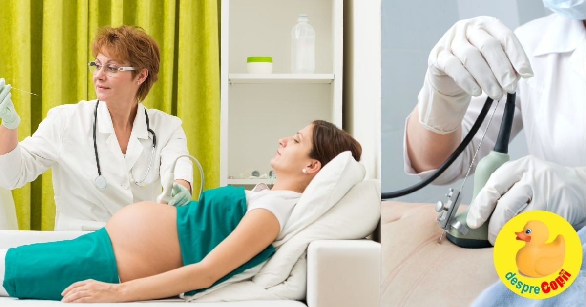 Amniocenteza in sarcina: ce detecteaza, factori de risc si consiliere genetica - sfatul medicului