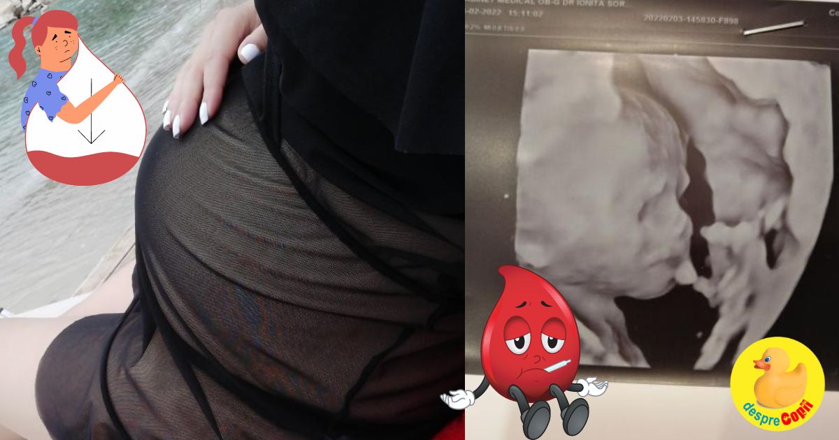 Anemia in sarcina nu e de gluma: oare cum am sa trec peste asta cu bine? - jurnal de sarcina