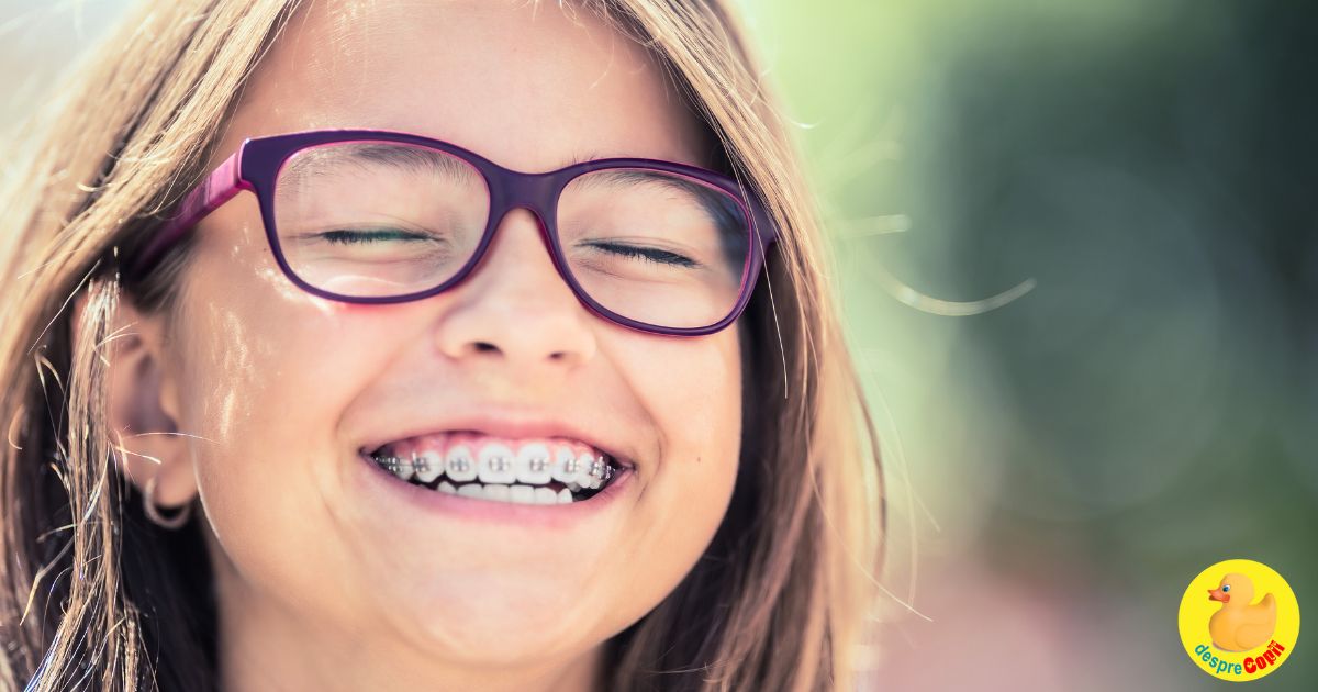 10 mituri si realitati despre aparatele dentare pentru copii, adolescenti si adulti - sfaturi de la specialisti