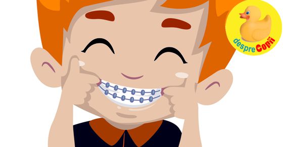 7 ani - varsta optima pentru primul aparat dentar
