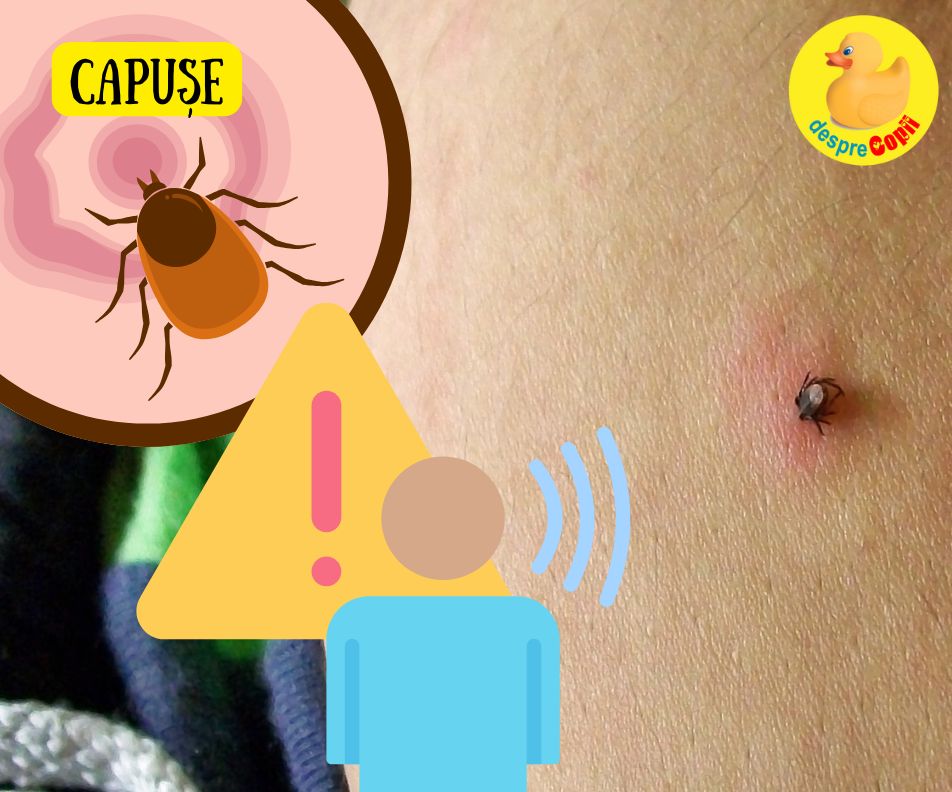 Capusele si copiii: Ce trebuie sa stim cu adevarat despre riscuri, preventie si reactia corecta
