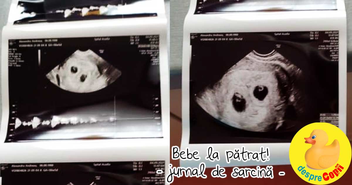 Bebe 2 e de fapt bebe la patrat, vom avea gemeni! - jurnal de sarcina