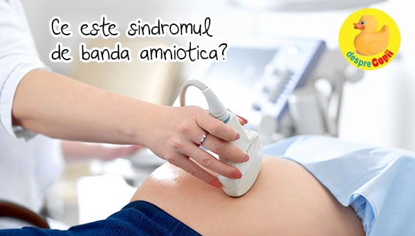 Sindromul de banda amniotica: simptome si urmari