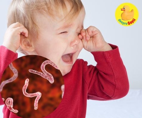 Bebe are viermi intestinali? Simptomele si tratamentul in caz ca bebelusul este contaminat cu oxiuri - sfatul medicului pediatru