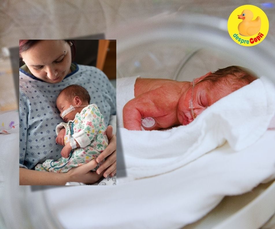 Ce mi-as fi dorit sa stiu despre a avea un bebe prematur - confesiuni