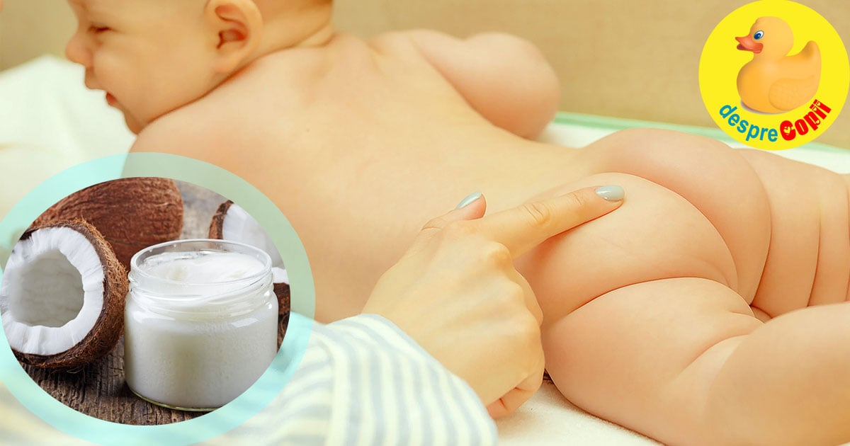 Iritatia de scutec a bebelusului - iata cum o putem trata cu ulei de cocos