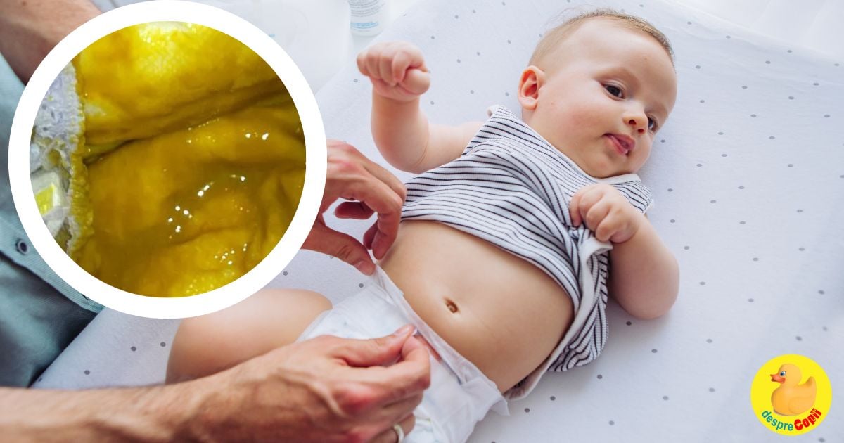 Confused cheese Affectionate Bebelusul are mucus in scaun - care sunt cauzele? Sfatul medicului  pediatru. | Desprecopii.com