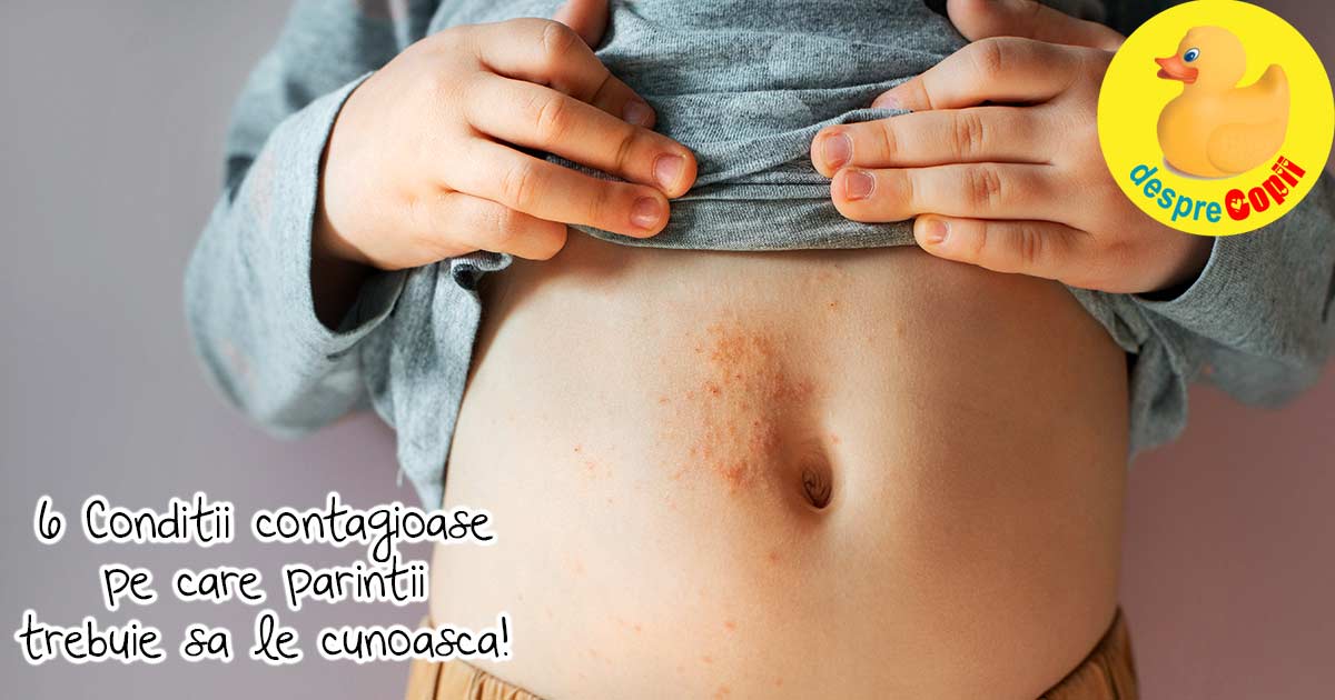 6 boli contagioase pe care multi copii le au iar parintii nu le cunosc si recomandarile medicului