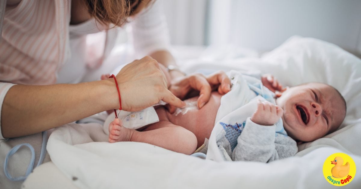 Igiena corecta a buricului nou-nascutului - 10 sfaturi pentru parinti de la medicul pediatru