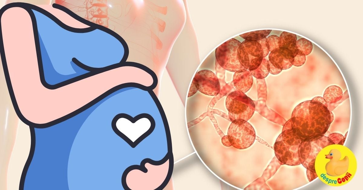 Infectia cu candida in sarcina: cauze, consecinte si tratament fara antibiotice