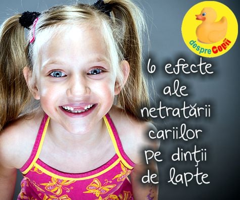 Dintii de lapte sunt importanti: 6 efecte ale netratarii cariilor pe dintii de lapte