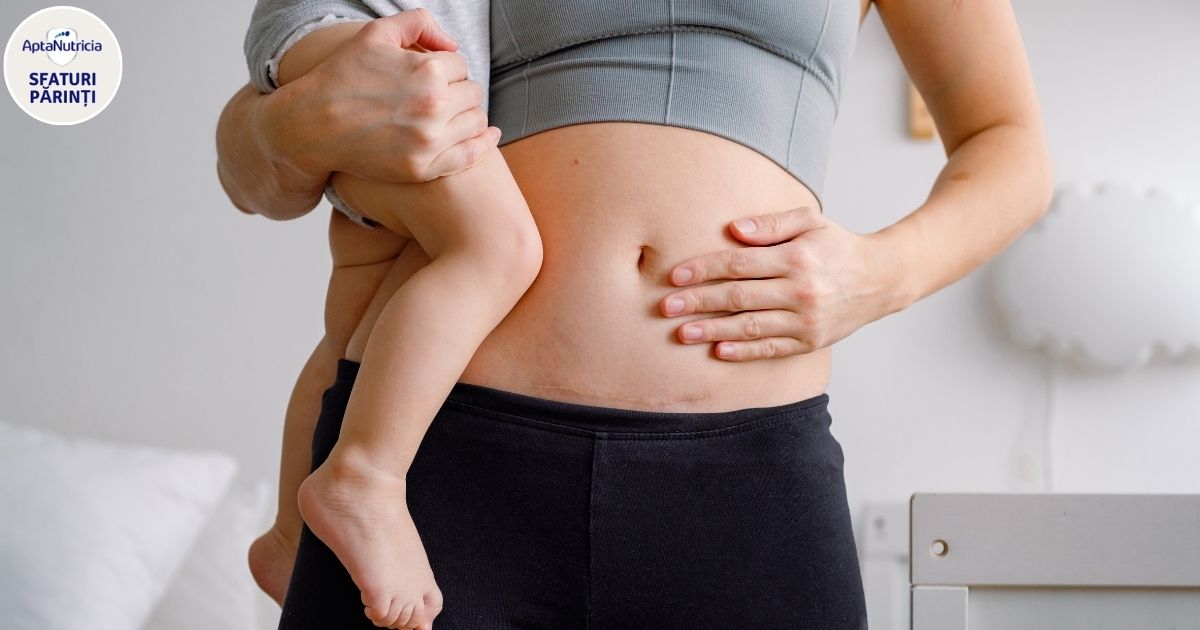 Nasterea prin operatie cezariana: Procedura, recuperare si impact asupra sanatatii nou-nascutilor
