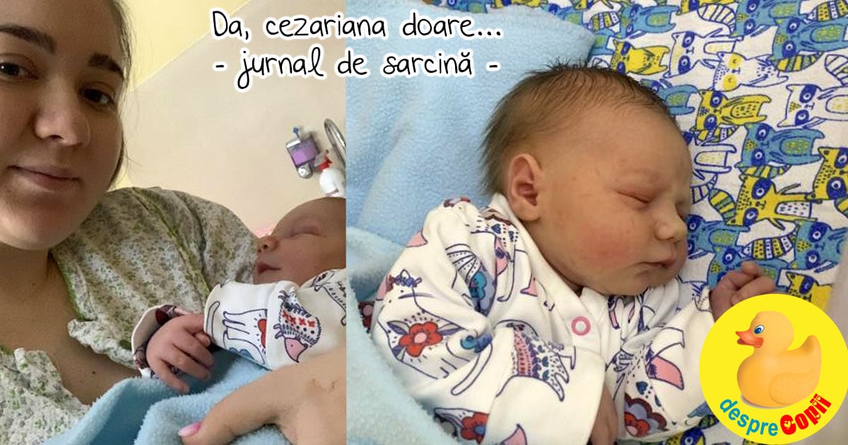 Nimeni nu mi-a spus cât de tare doare cezariana - confesiunile unei mamici