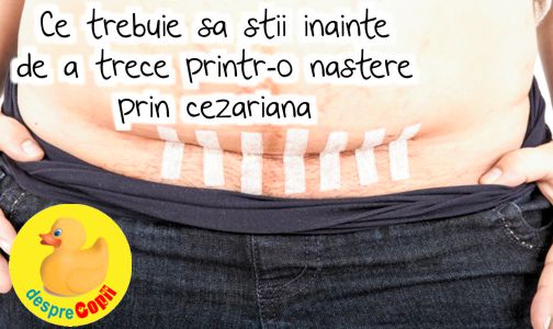 Ce trebuie sa stii inainte de a trece printr-o nastere prin cezariana