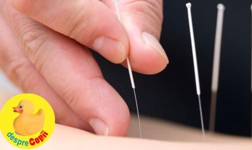 Poate acupunctura calma colicii unui bebelus?