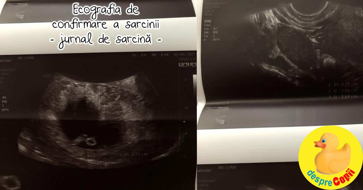 Ecografia de confirmare a sarcinii in saptamana 6 - jurnal de sarcina