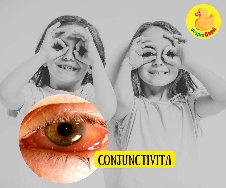 Conjunctivita la copil este extrem de comuna - ce tipuri exista, cauze si tratament - sfatul medicului