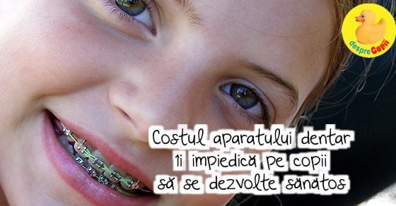 Costul aparatului dentar ii impiedica pe copii sa se dezvolte sanatos