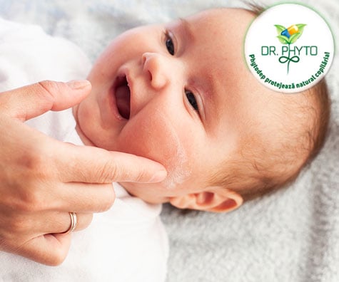 Dermatita atopica la copii - cauze, simptome, evolutie si tratament