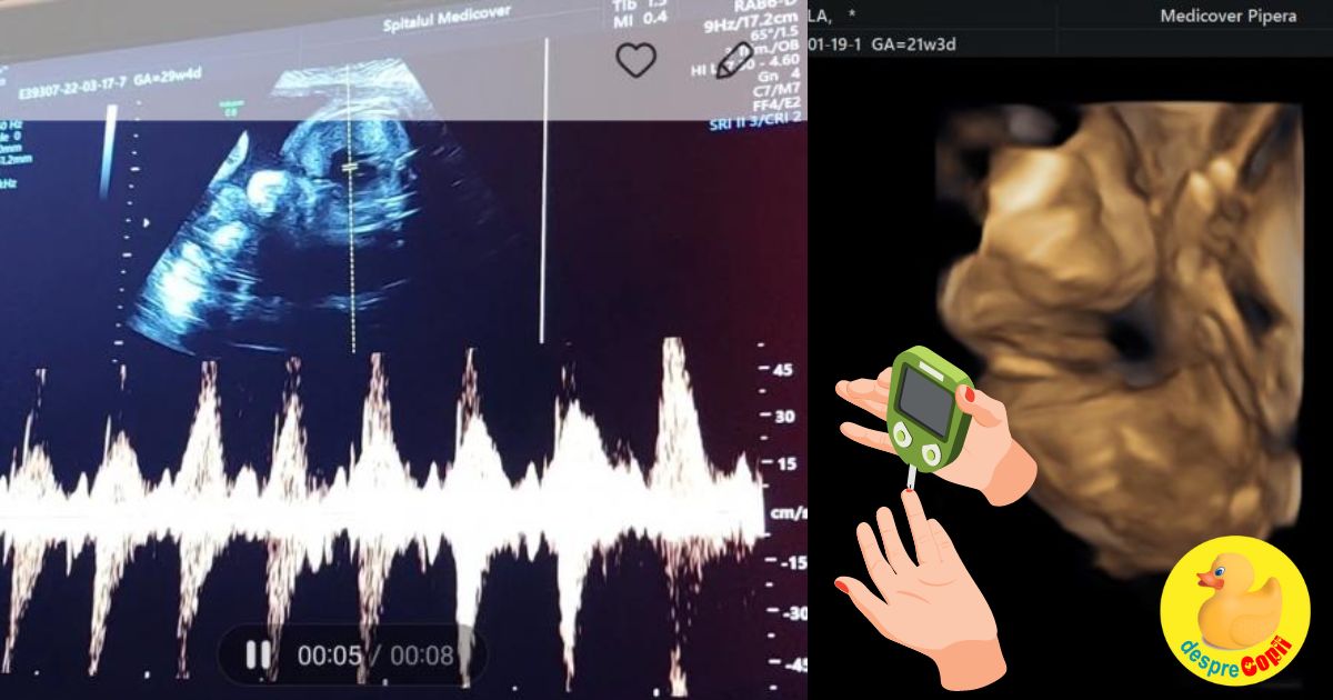 Am facut testul de toleranta la glucoza in trimestrul de sarcina iar valorile sunt mai mari decat trebuie - jurnal de sarcina