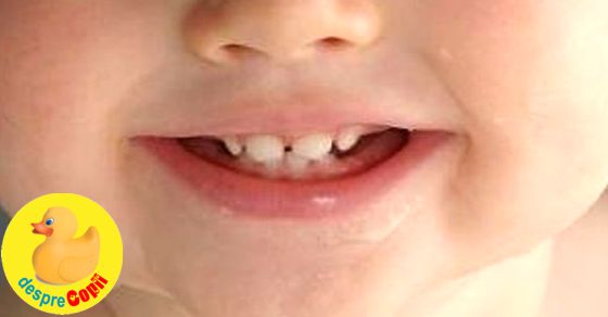 Ghid complet de ingrijire dentara din primul an de viata al copilului