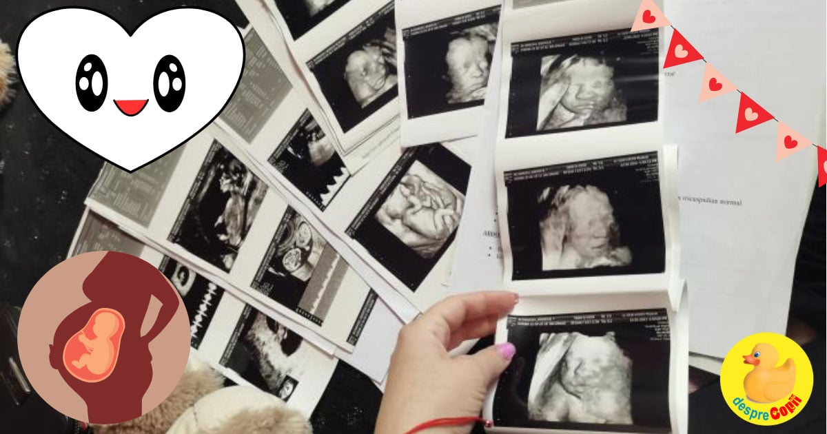 Ecografiile din sarcina: primul album foto al bebelinei - jurnal de sarcina