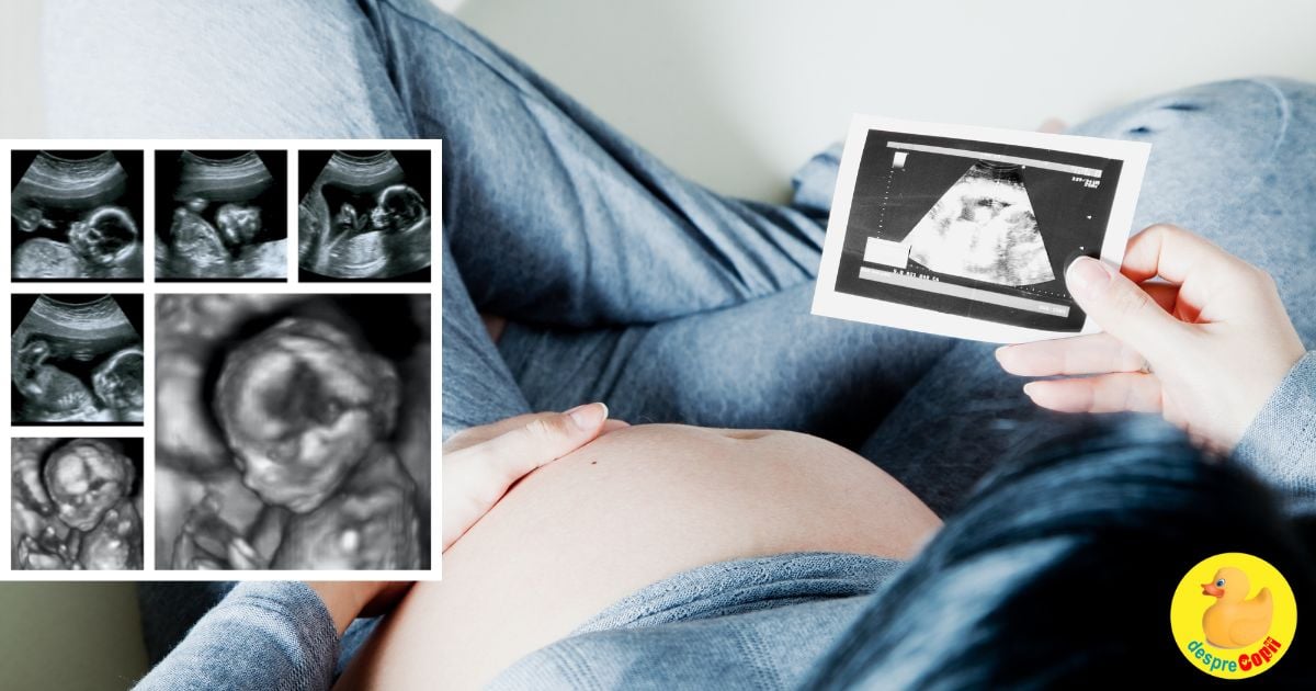 Ecografiile 3D si 4D in timpul sarcinii: ce sunt si care este rolul lor
