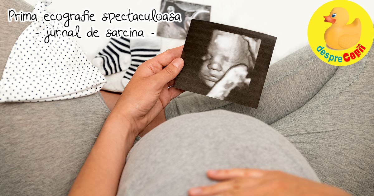 Prima ecografie spectaculoasa 3D/4D si un bebe delicat - jurnal de sarcina