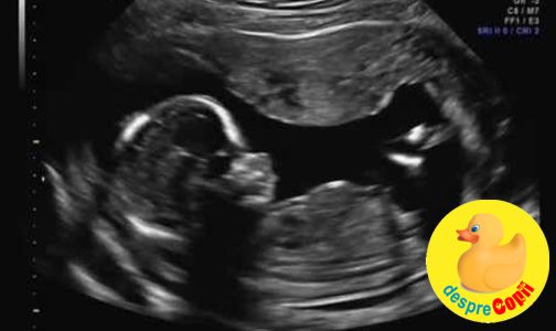 Ecografiile prenatale – o necesitate?
