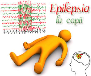 Epilepsia la copil