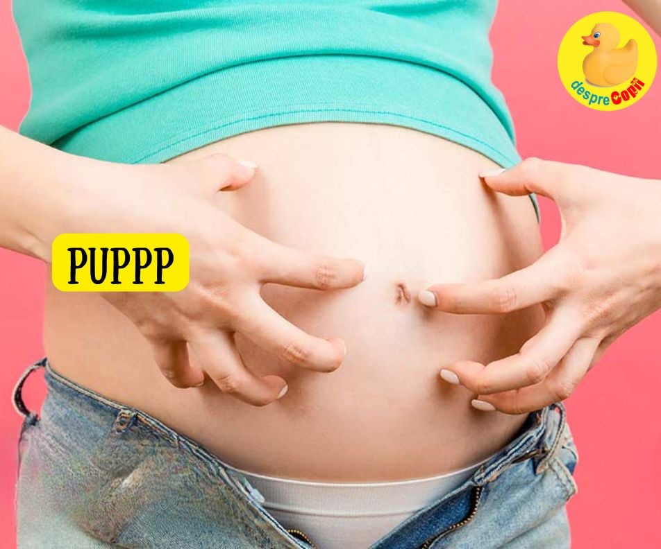 Eruptia cutanata PUPPP in timpul sarcinii - ce o cauzeaza si cum trebuie tratata