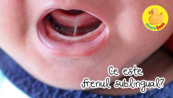 Frenul sublingual sau ankyloglossia