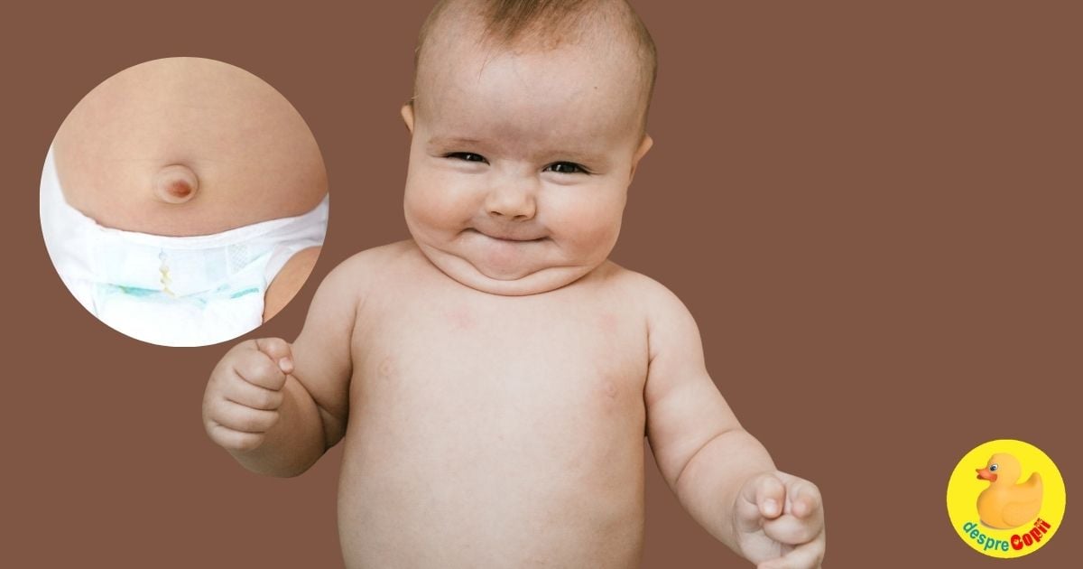 Hernia ombilicala la bebelus -  simptome si gestionare corecta a situatiei
